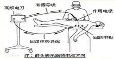 有源器械和無源器械是什么？解釋來了，給我碼住！